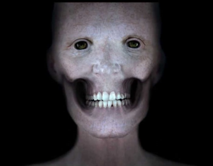 Elu5-inimese nägu ilma lihasteta