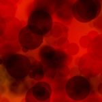 vereplasma