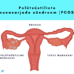 polütsüstilised munasarjad ehk polütsüstiliste munasarjade sündroom PCOS